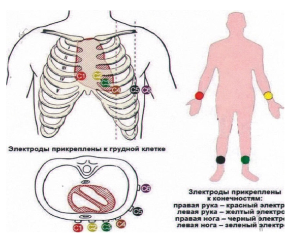 Процедура подготовки, выполнение электокардиографии